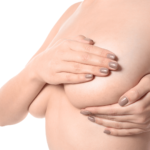 zmenseni bradavek gia clinic