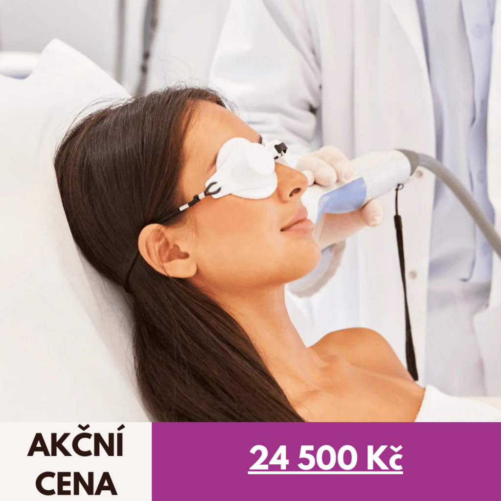 Promocje - Pred Po nove 73