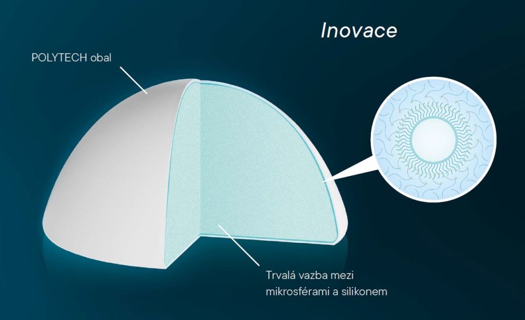 Rekonstrukce prsou - paní Šárka - blite obr inovace 1024x625 1